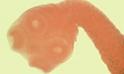 Taenia saginata